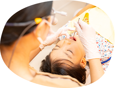 こどもの虫歯管理（3～11歳）