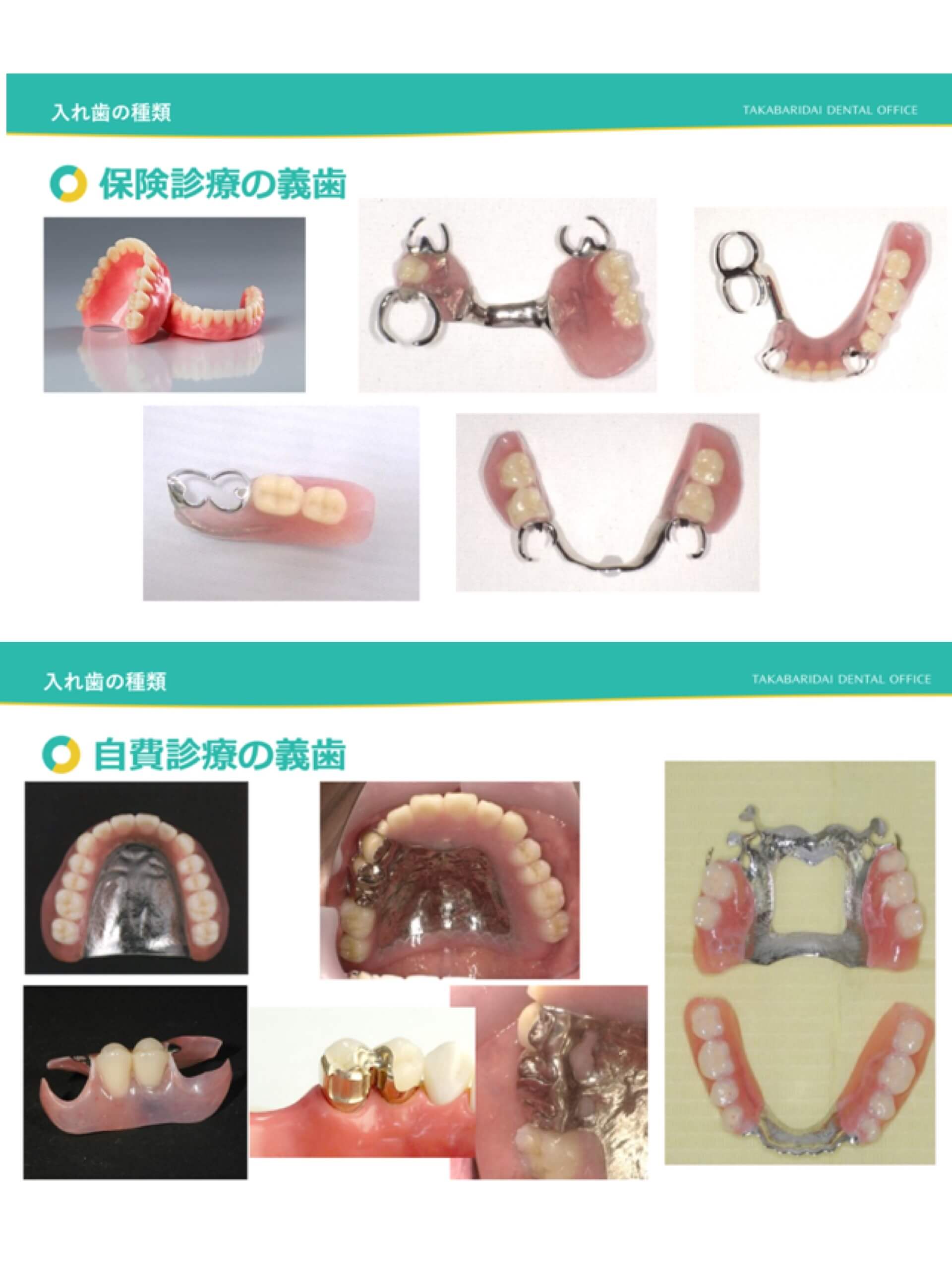 どんな義歯があるか気になりませんか？